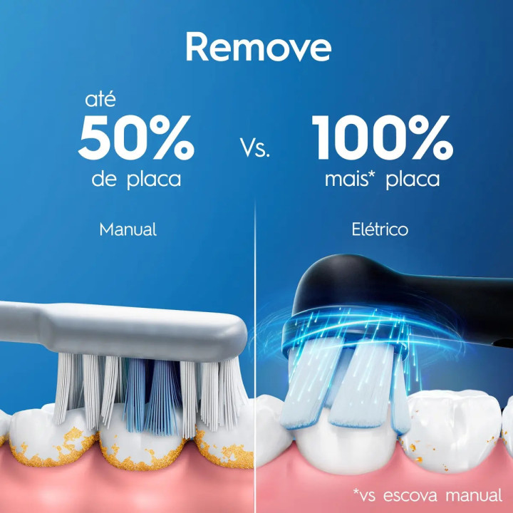 Escova De Dente Elétrica Oral-b Io2, 1 Cabo + 1 Refil + Carregador | Escovas Elétricas